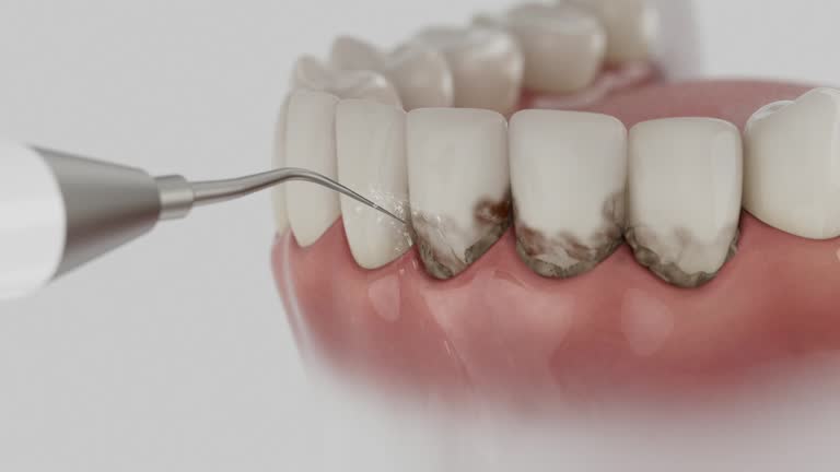 Trusted Teeth Cleaning And Checkup service in Hermitage, PA - Dentist Open Now